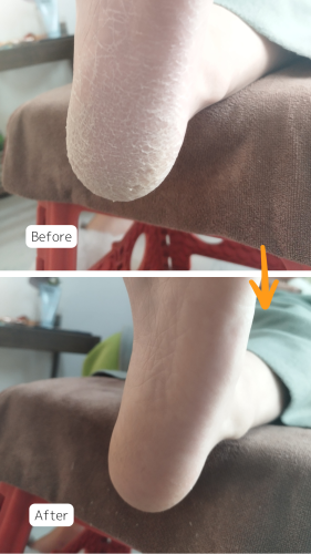 症例ハイライト - 15.png