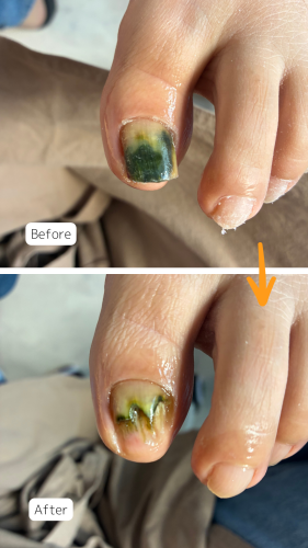 症例ハイライト - 22.png