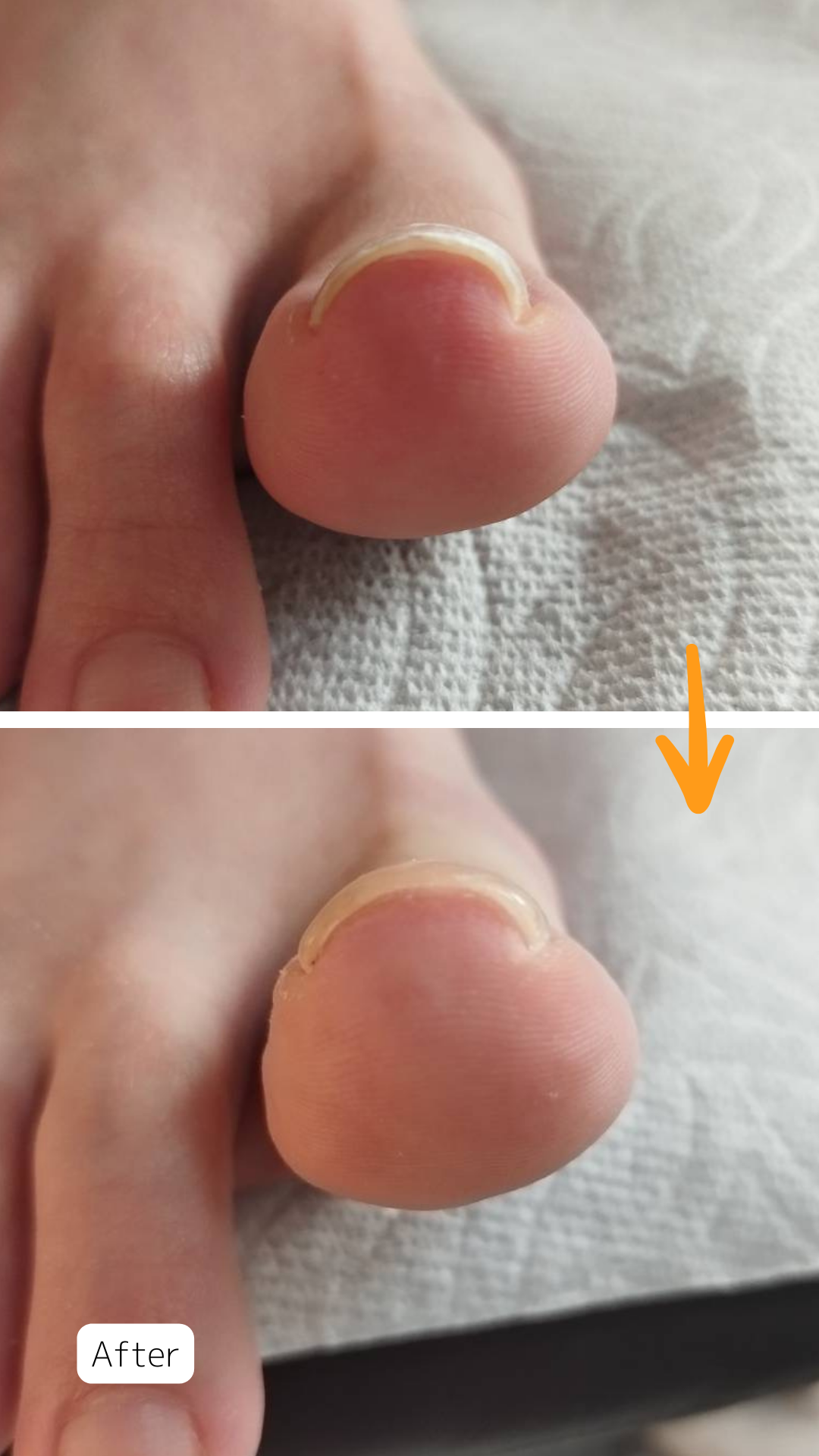 症例ハイライト - 5.png