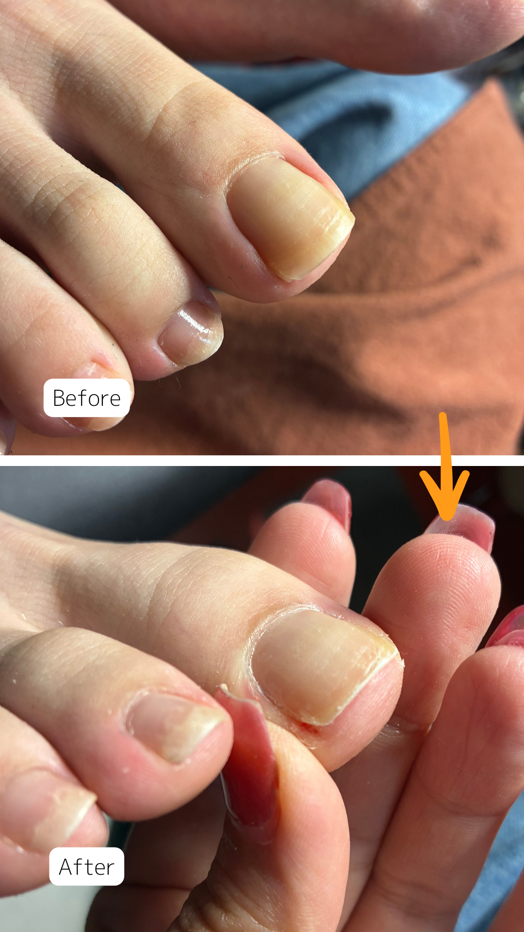 症例ハイライト - 18.png