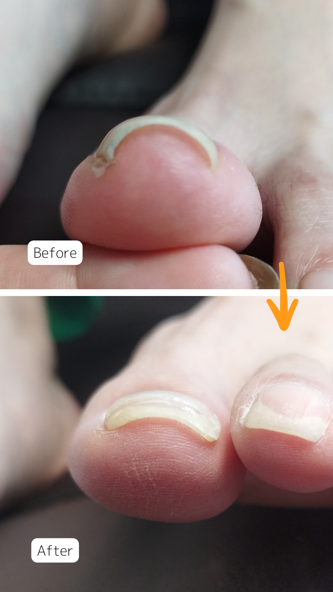 症例ハイライト - 1.png