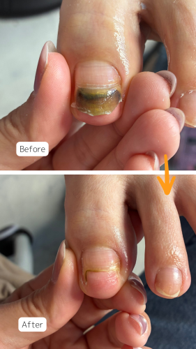 症例ハイライト - 23.png