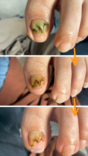 症例ハイライト - 27.png