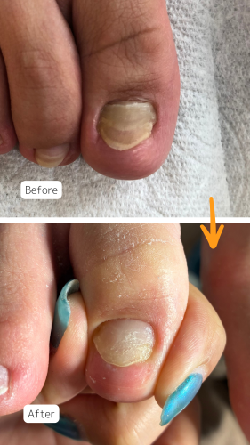 症例ハイライト - 26.png