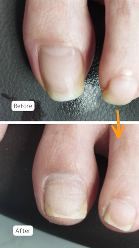 症例ハイライト - 9.png