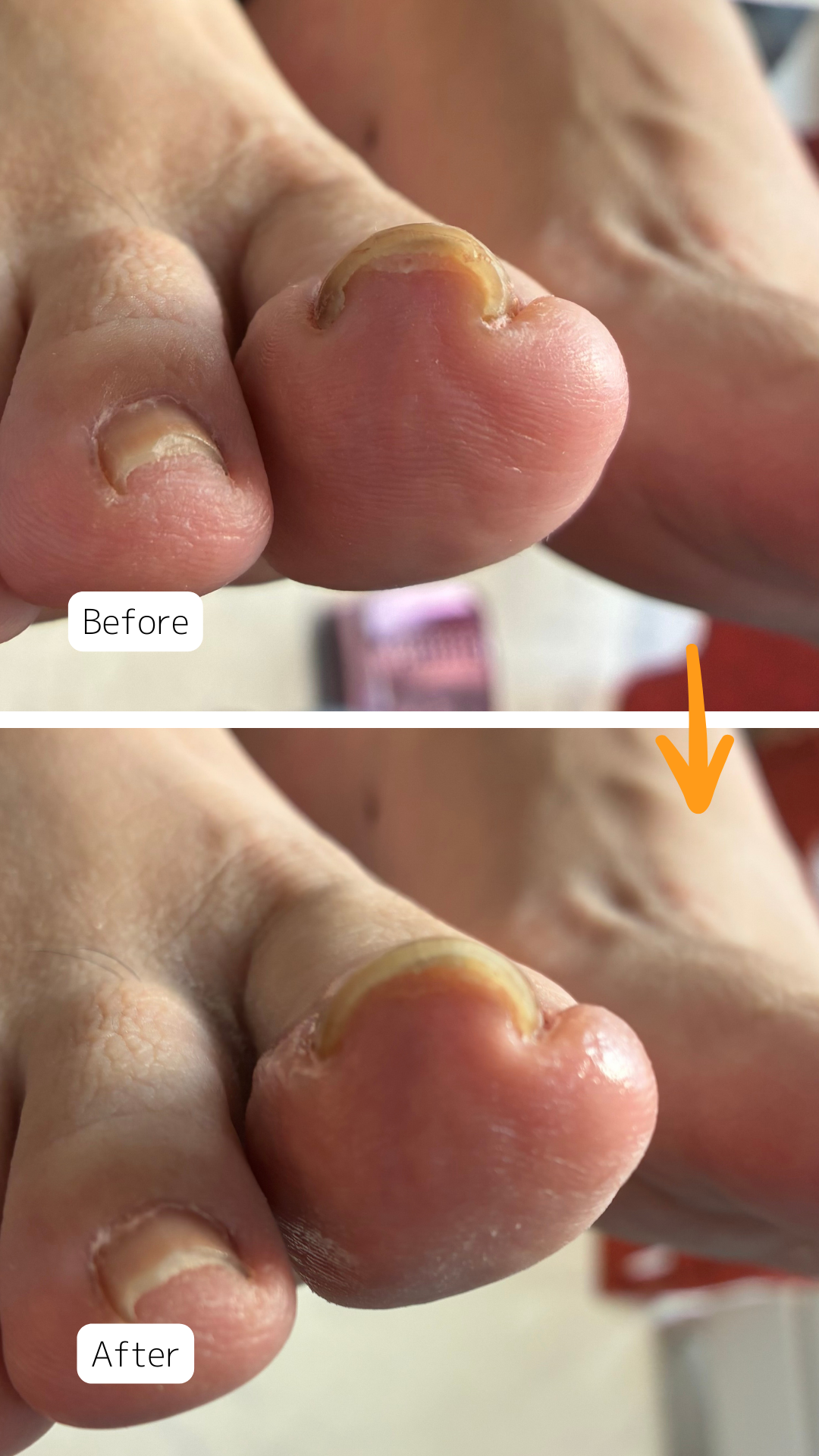 症例ハイライト - 10.png