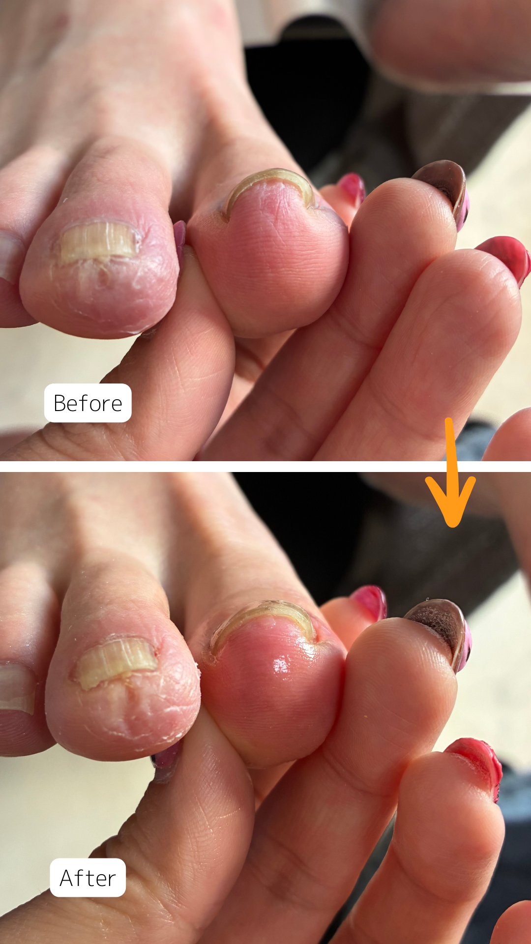 症例ハイライト - 21.png