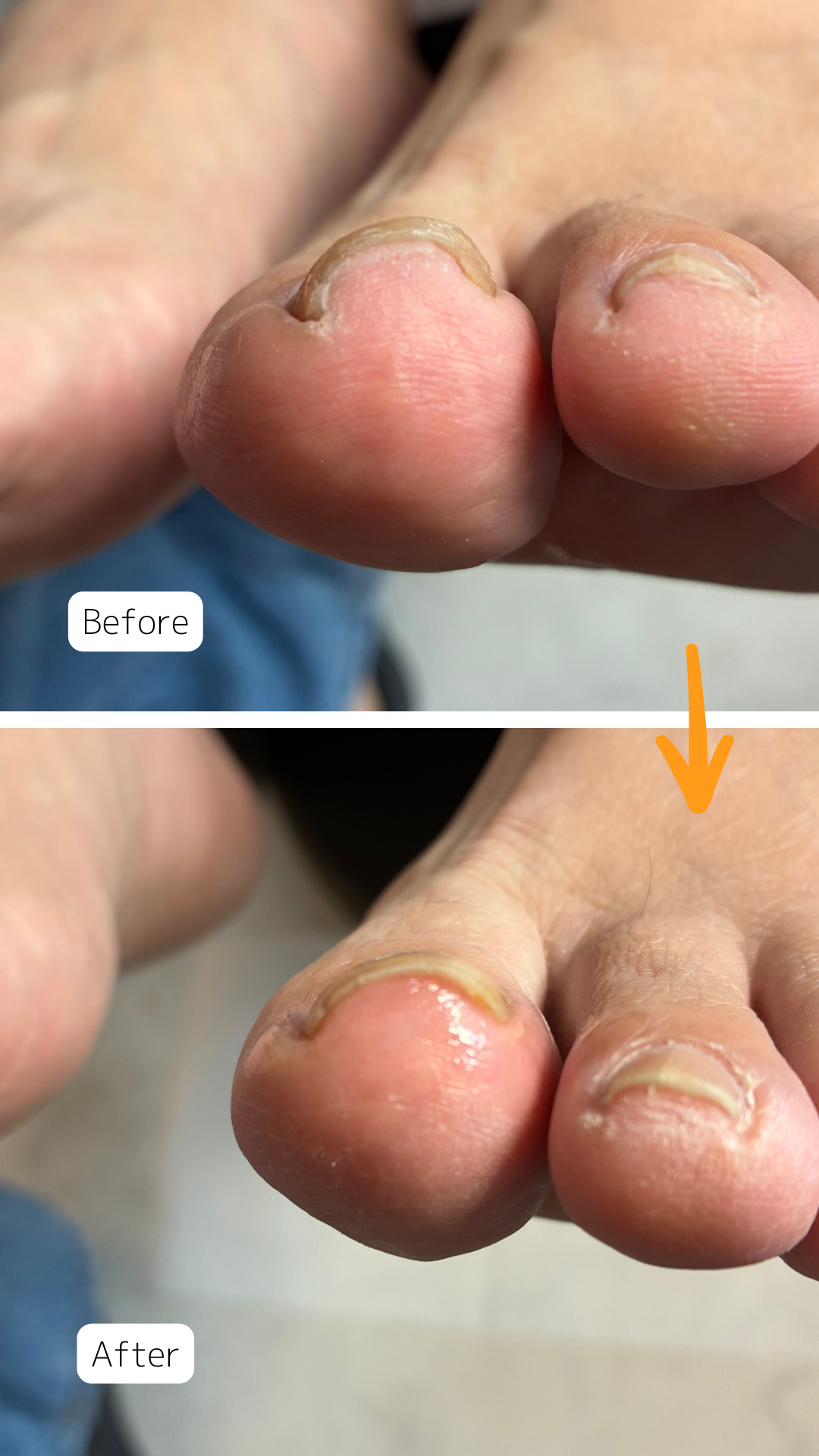 症例ハイライト - 17.png