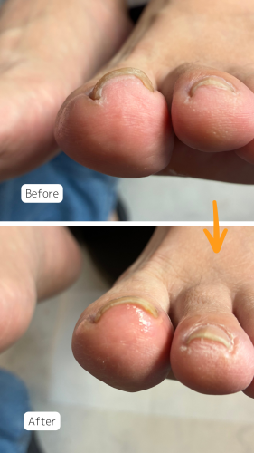 症例ハイライト - 17.png