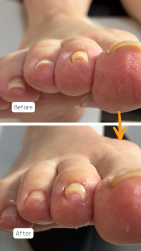 症例ハイライト - 3.png