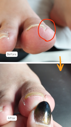 症例ハイライト - 11.png