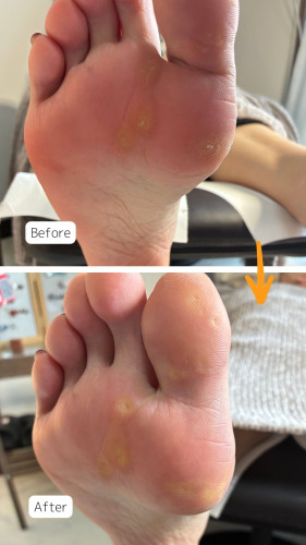 症例ハイライト (1).jpg