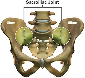 SI-Joint-1.png.jpg