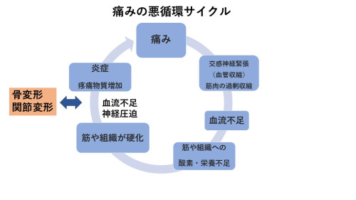 痛みの悪循環サイクル.jpg