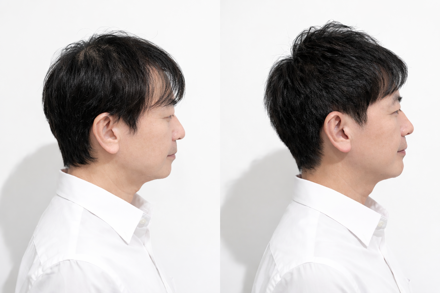 ヘアスタイル写真