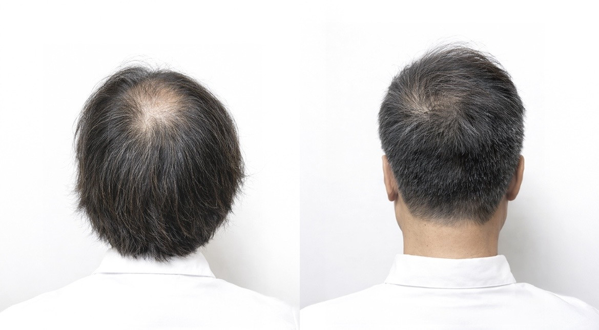 ヘアスタイル写真