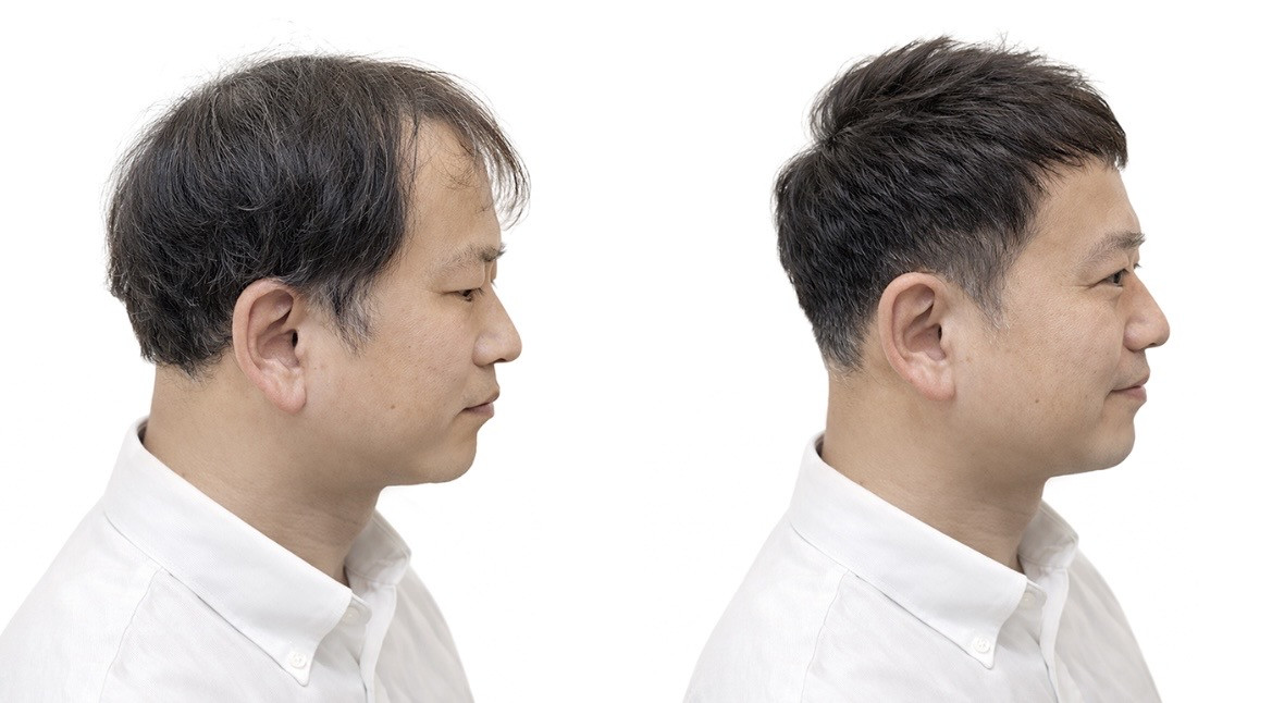 ヘアスタイル写真