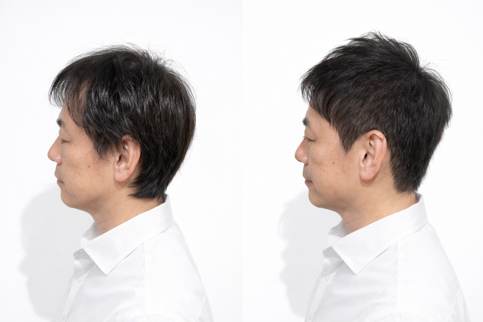 ヘアスタイル写真