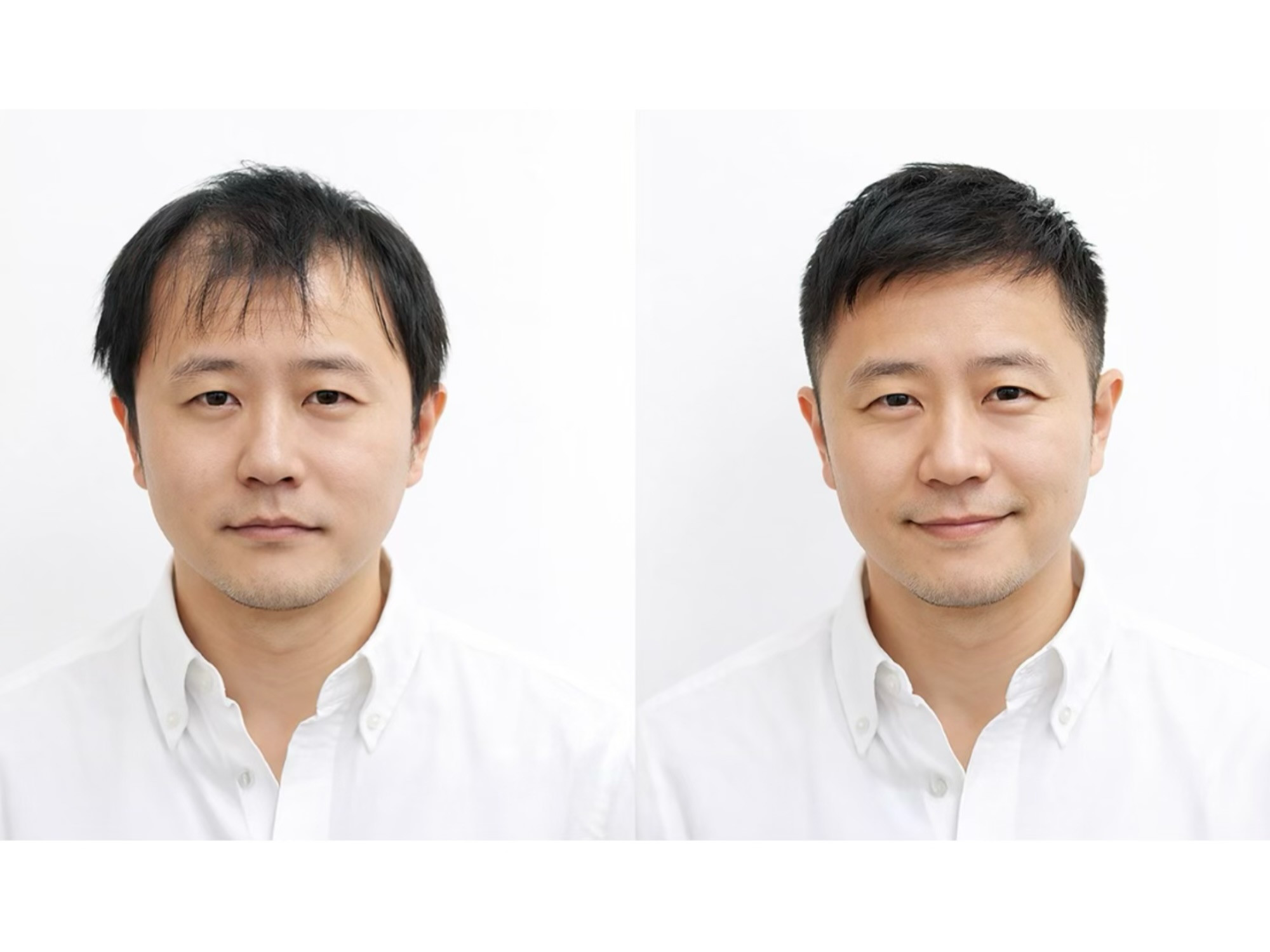 ヘアスタイル写真