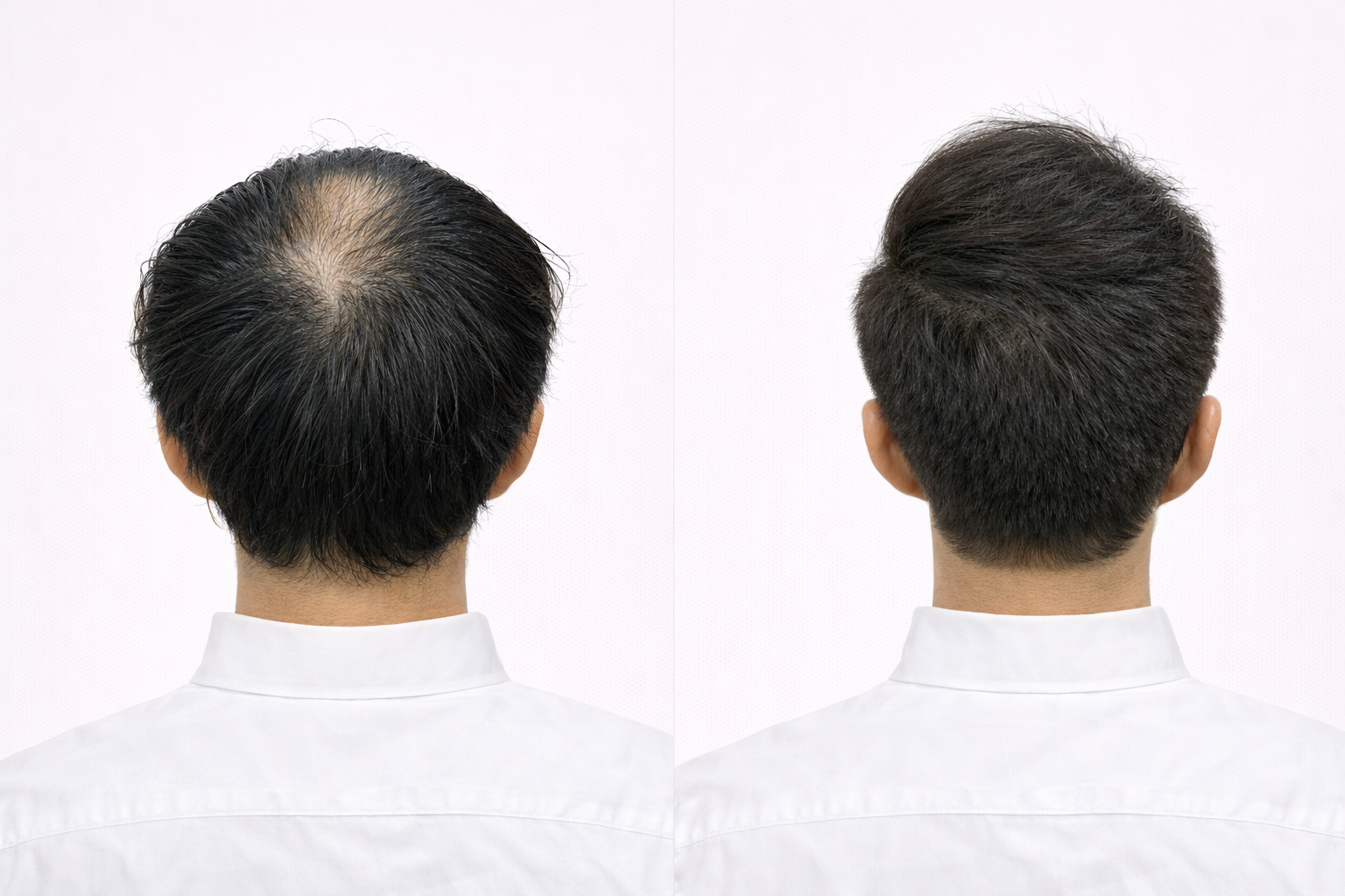 ヘアスタイル写真
