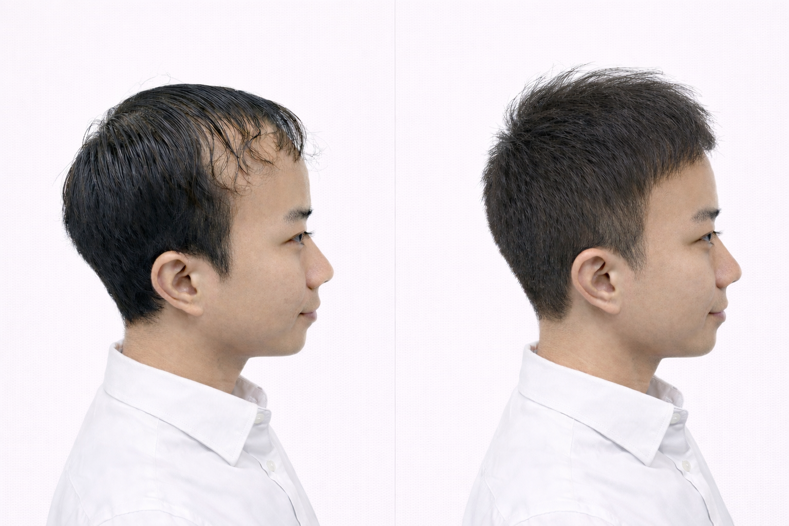 ヘアスタイル写真