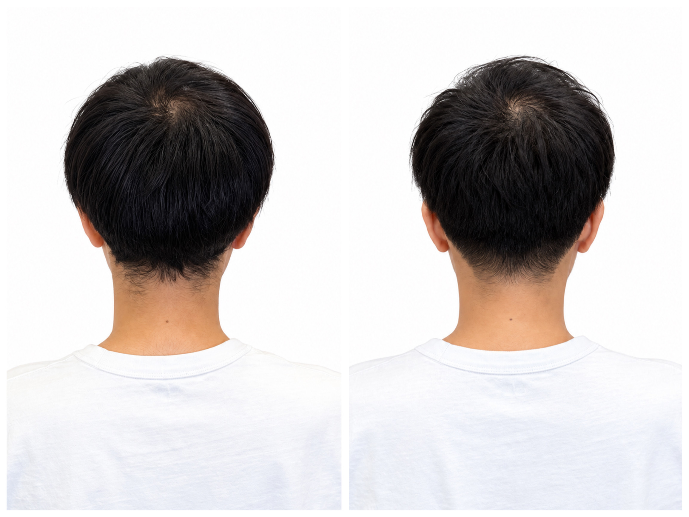 ヘアスタイル写真