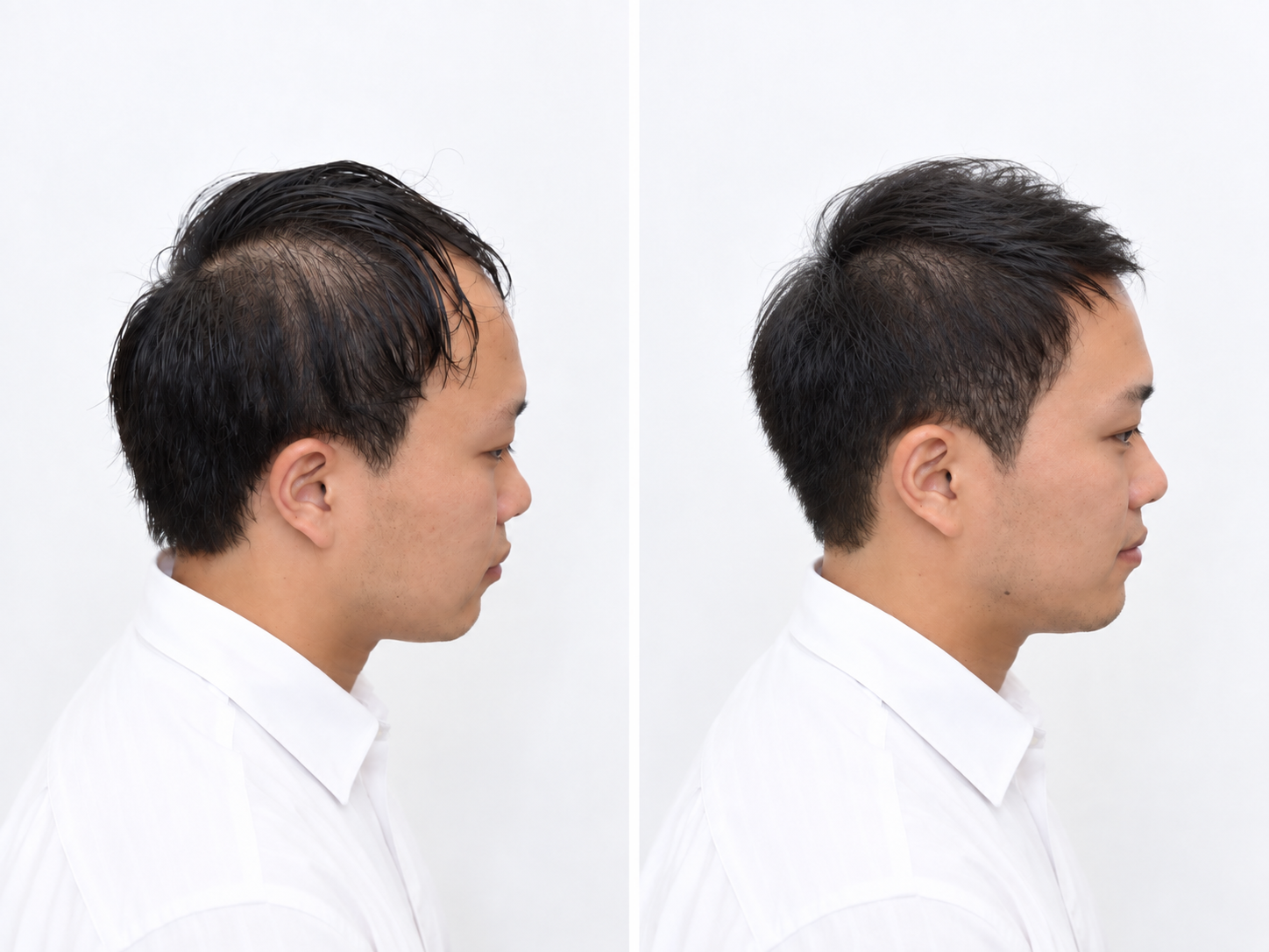 ヘアスタイル写真