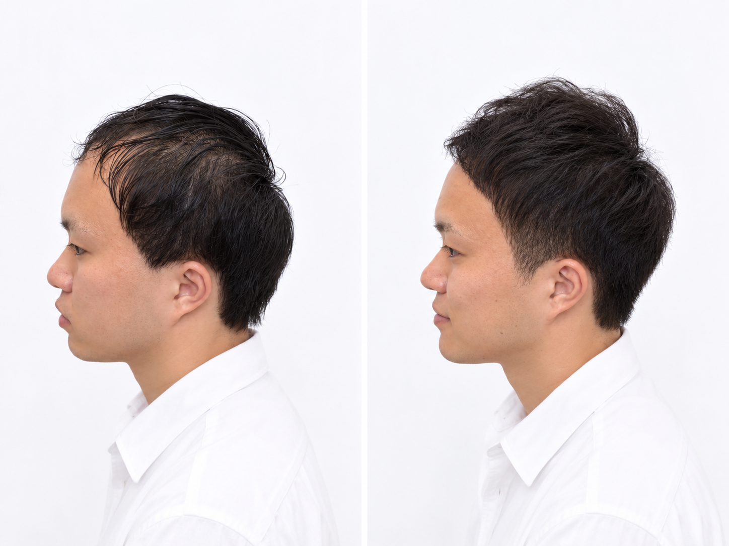 ヘアスタイル写真