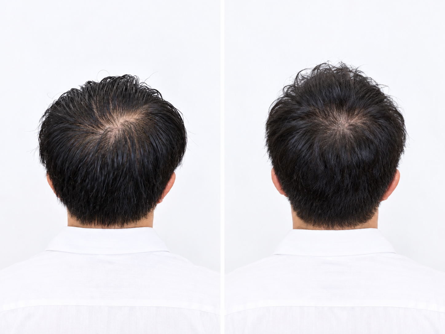 ヘアスタイル写真
