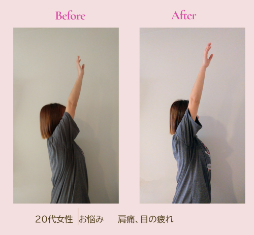 Before.png