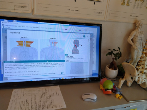 アトラゲージ