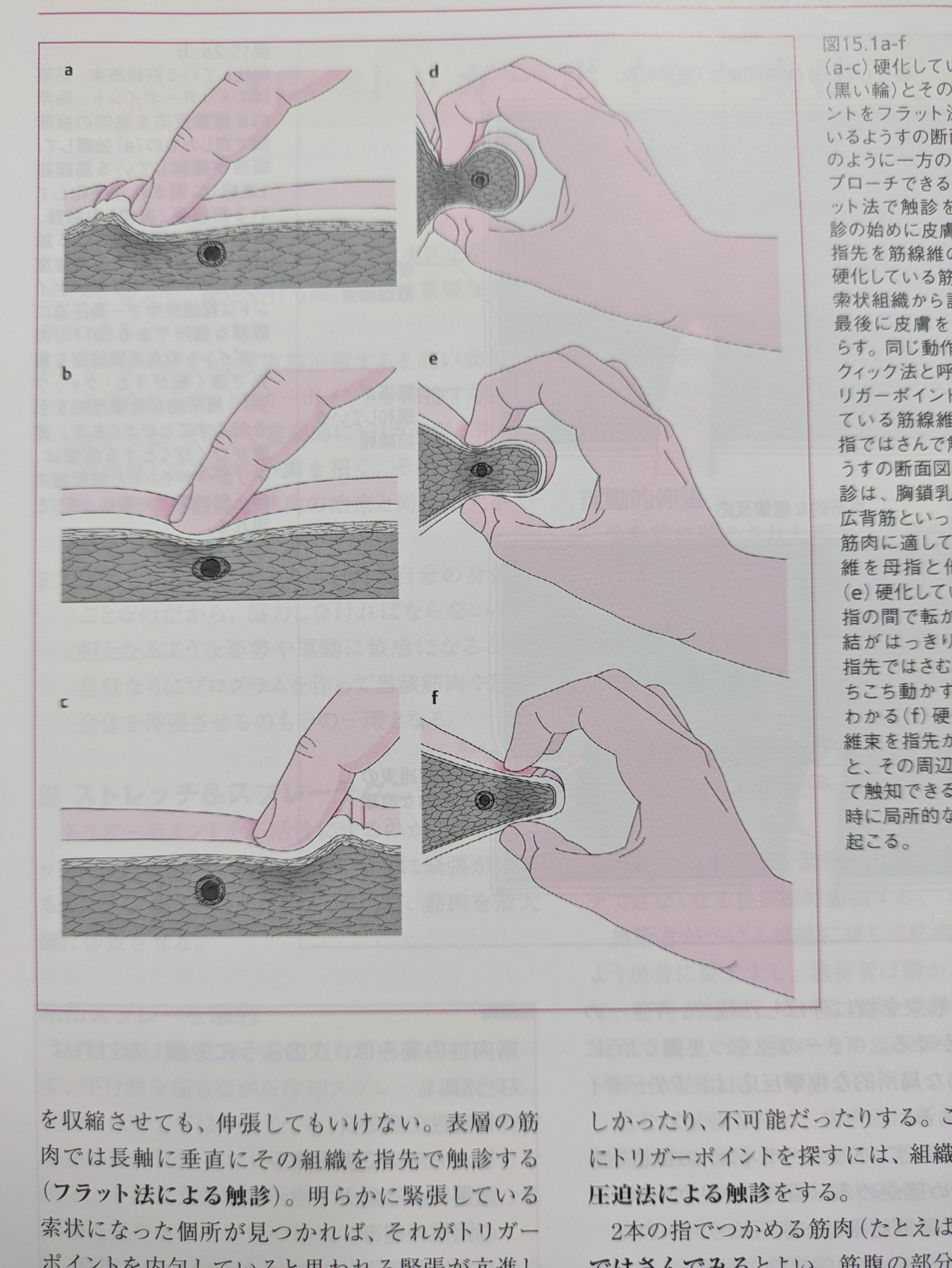 トリガーポイント