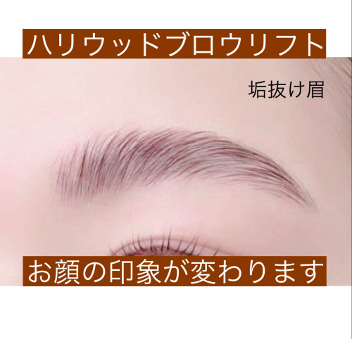 まゆ毛施術例2