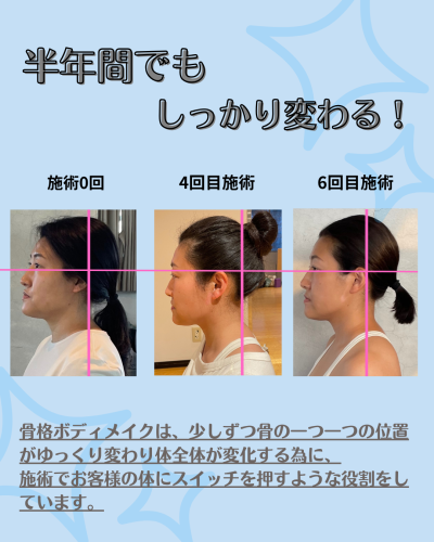 顔の変化_01のコピーのコピー.png