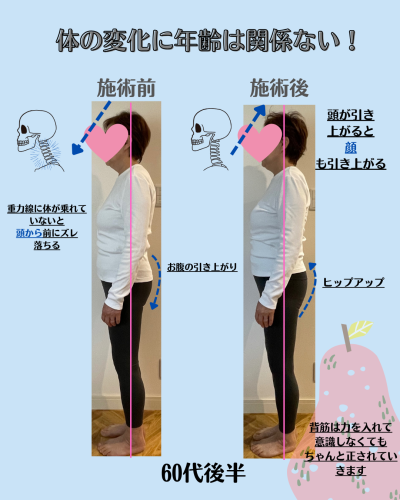 歩きと腕の変化_01_お母さん.png