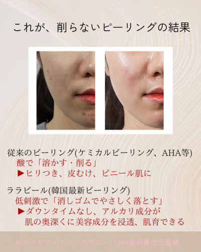 セルフホワイトニングサロンLUNA - 2.png