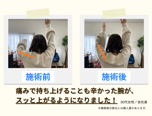 施術例のコピー (12).png