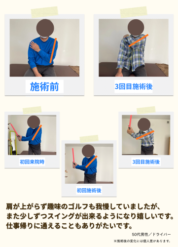 施術例のコピー (14).png