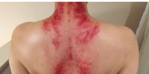 かっさとは Kampo Aromatherapy (1).png