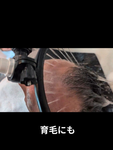 頭皮を柔らかく