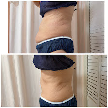 たった1回・当日の前後