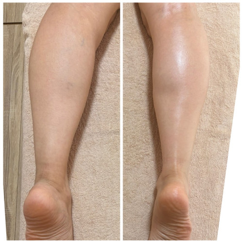 右側だけしました