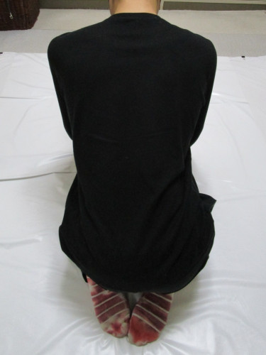 野球肩＋野球肘　施術後re.JPG