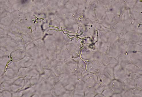白癬菌（水虫・爪水虫）対応、施術条件と趣旨について
