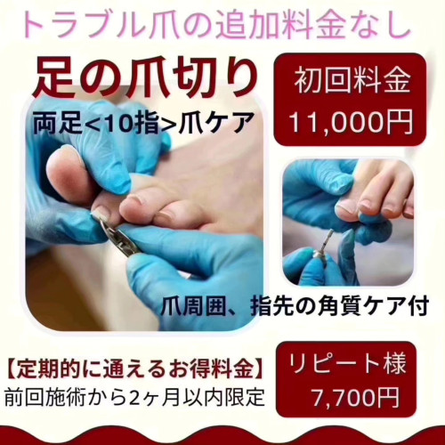 「町田市で高齢者の足の爪切りでお困りの方」お任せください。
