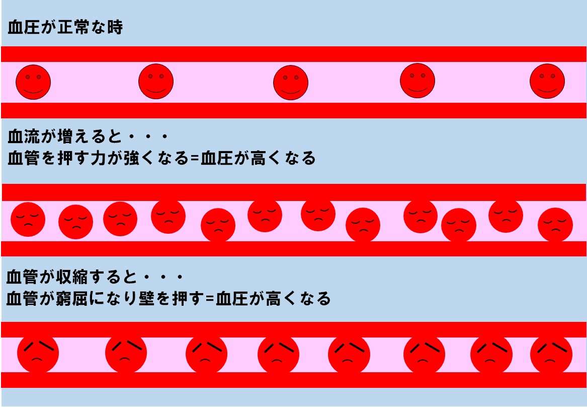 イブプロフェンの過剰使用による高血圧はどのように治療されますか?