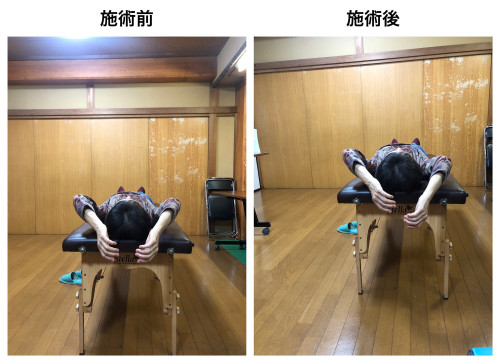 2024.10.28 さとう式before after.JPG
