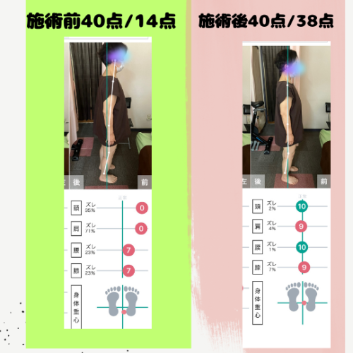 施術前A.png