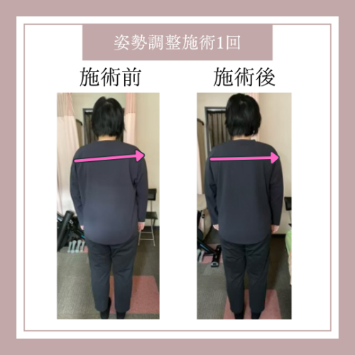 姿勢調整施術1回.png