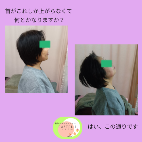 首がこれしか上がらなくて.png